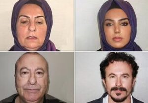 کلینیک جراحی پلاستیک در استانبول؛ نمونه کارها جعلی یا واقعی؟