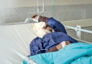 برای مهدی، اکبر، حامد و …/ آخرین وضعیت کارگرانی که در انفجار بندرعباس از یک یا دو چشم نابینا شدند