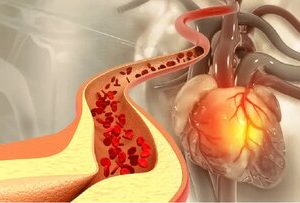 ادویه‌ای که کلسترول خون را کاهش می‌دهد