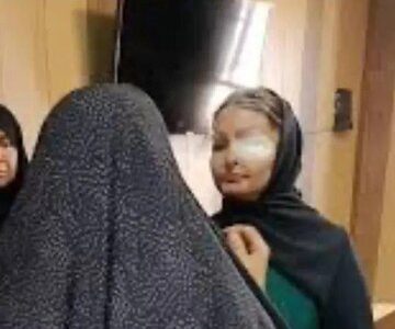 قربانی اسیدپاشی ضارب خود را پس از ۱۱ سال بخشید/ چرا سیما افشاری مورد اسیدپاشی قرار گرفت؟