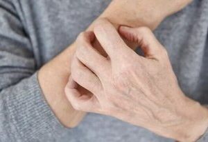 این نشانه‌ها یعنی بیماری پوستی