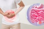 این رژیم غذایی ضد یبوست است