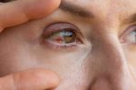 دلایل پارگی رگ خونی در چشم/ چه موقع باید به پزشک مراجعه کنیم؟